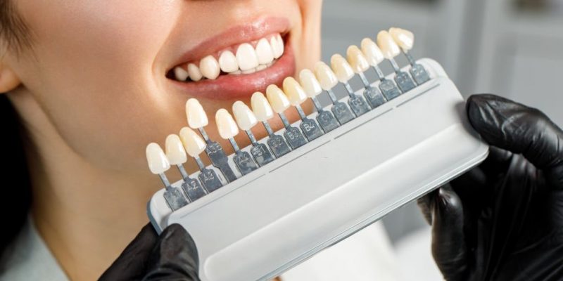 Affordable Tooth Replacement Options For Missing Teeth