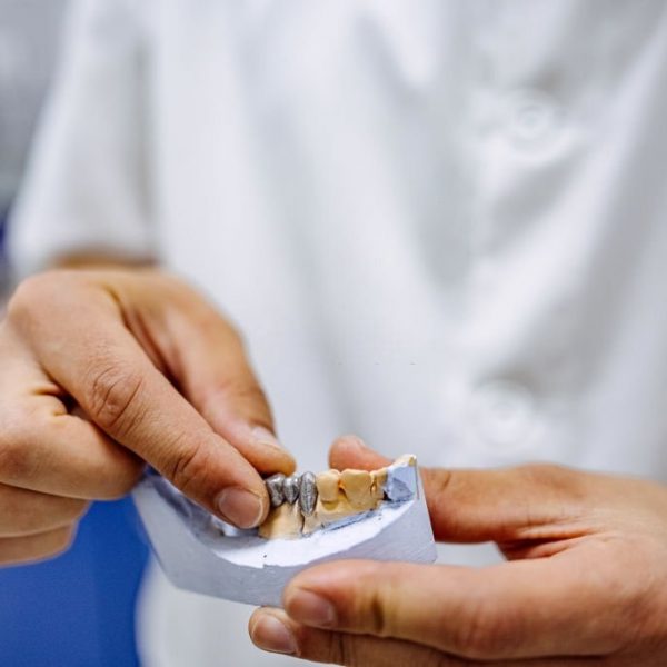 How Long Do Porcelain Crowns Last?