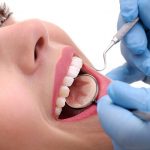 Cosmetic Dental Procedures in West Columbia SC