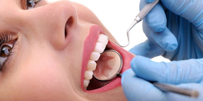 Cosmetic Dental Procedures in West Columbia SC