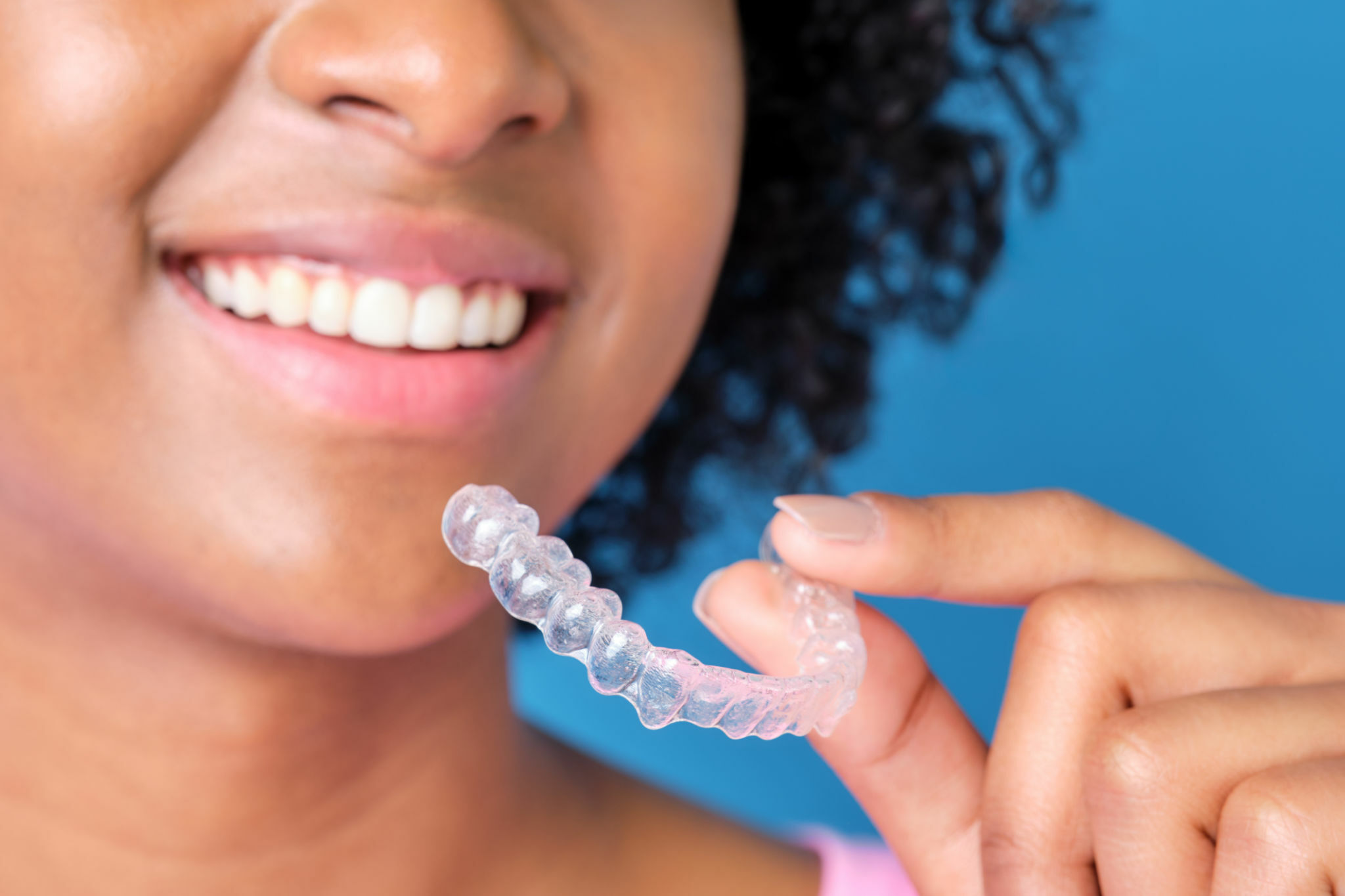 Invisalign Dentists vs. Traditional Orthodontists: What You Need to Know_1