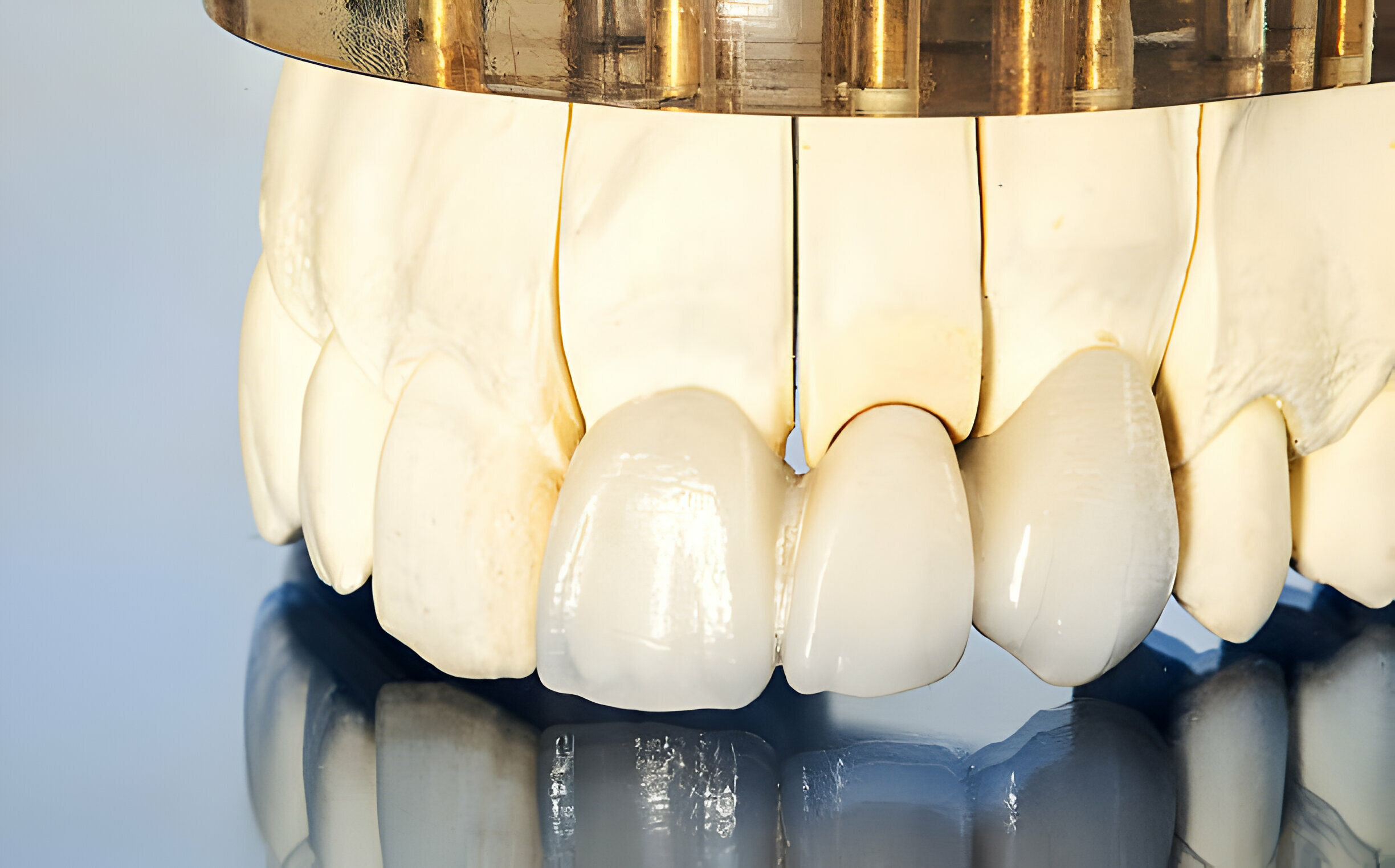 Everything You Need to Know About Dental Crowns vs. Dental Caps_3