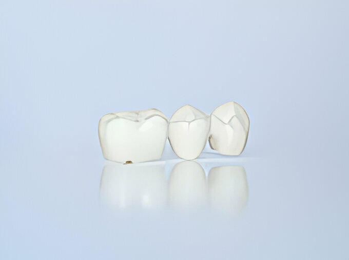 What to Expect When Getting A Dental Crown?_2