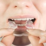 Managing TMJ-Related Issues: Tips from West Columbia’s TMJ Specialists