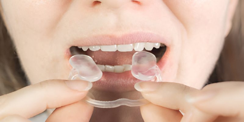 Managing TMJ-Related Issues: Tips from West Columbia’s TMJ Specialists