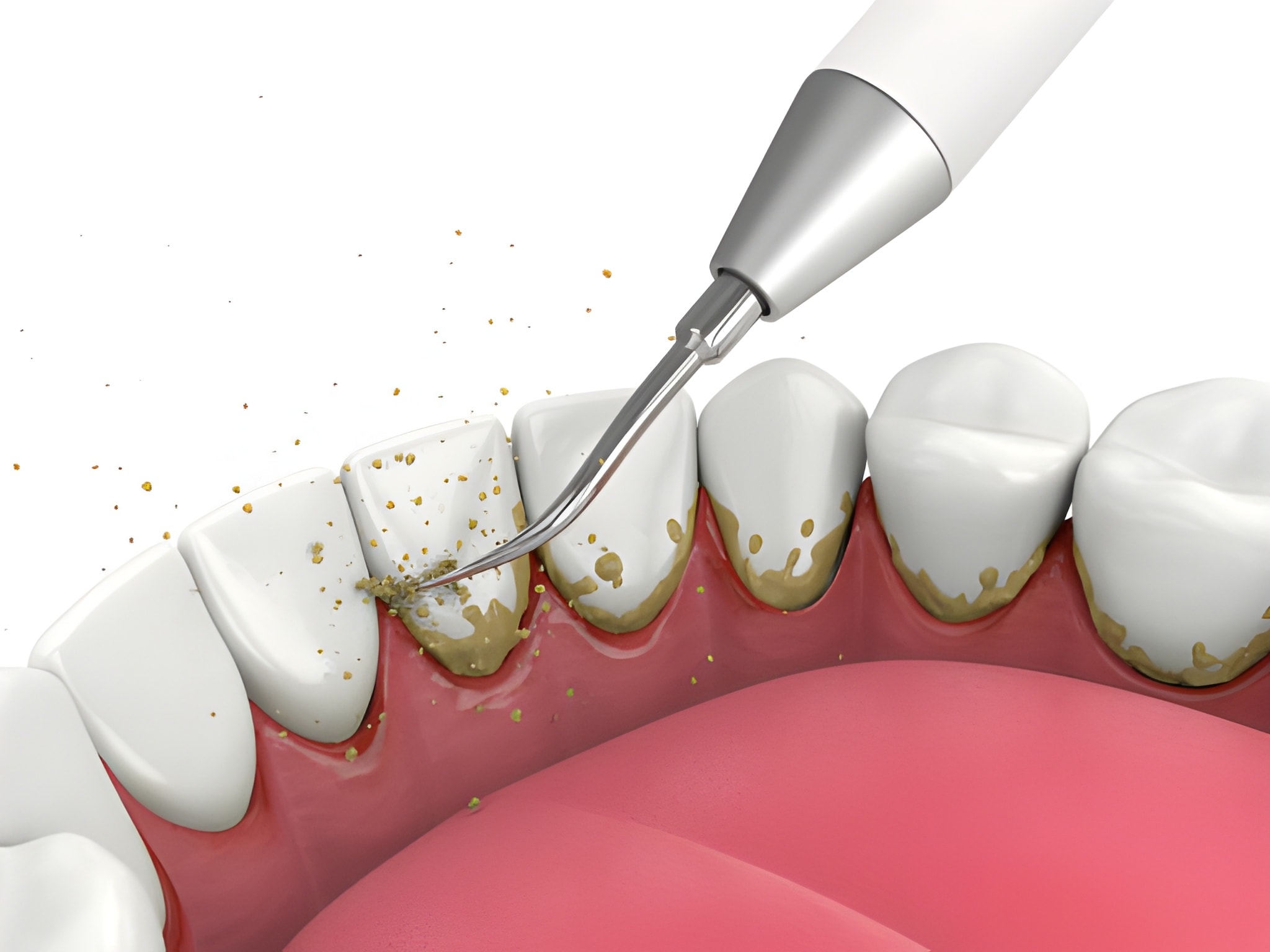 Carolina Smiles Family Dentistry’s Tips for Maintaining Oral Health with Regular Cleaning & Exams_FI