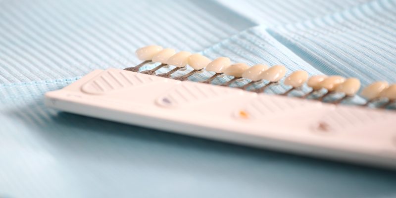 How Dental Veneers Work: Expert Insights from Carolina Smiles Family Dentistry, Columbia, SC_FI