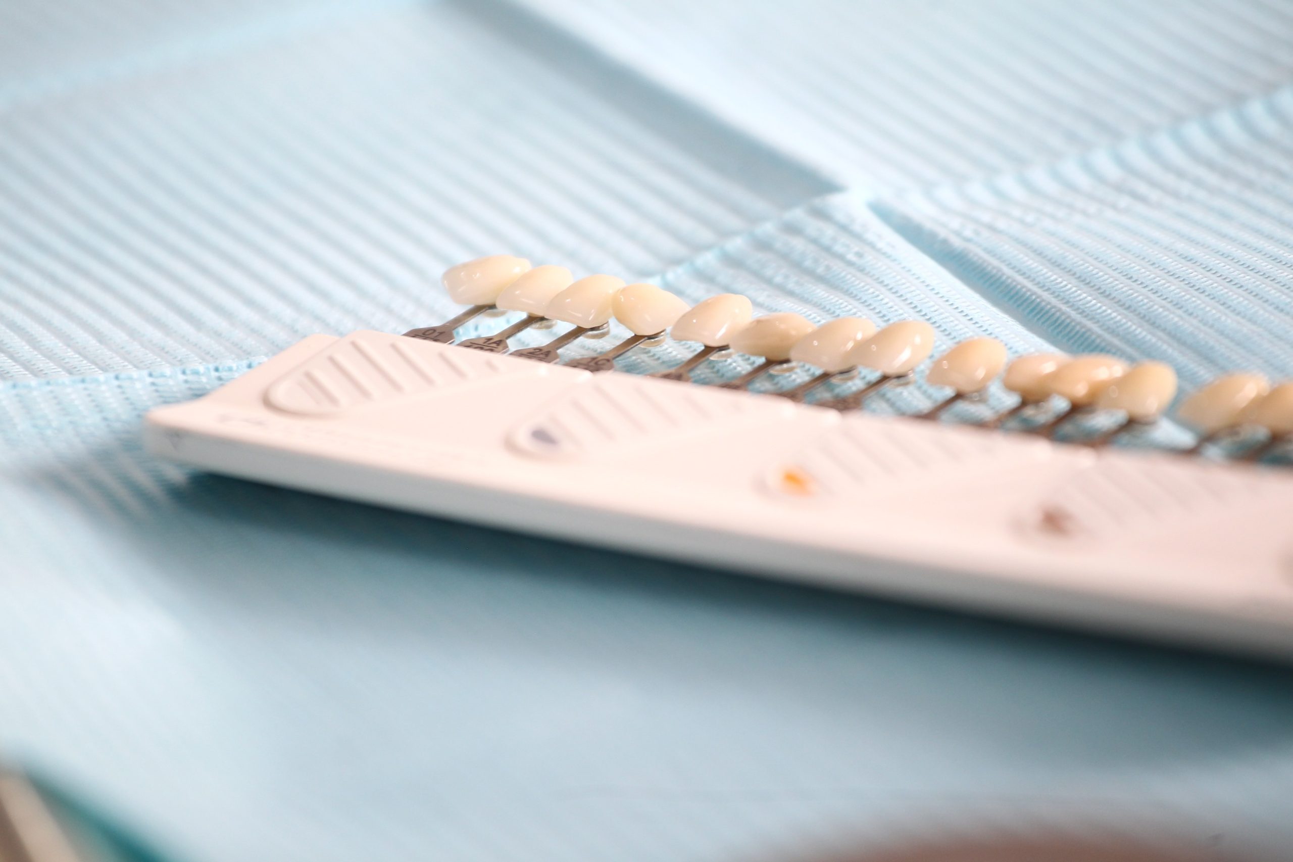 How Dental Veneers Work: Expert Insights from Carolina Smiles Family Dentistry, Columbia, SC_FI